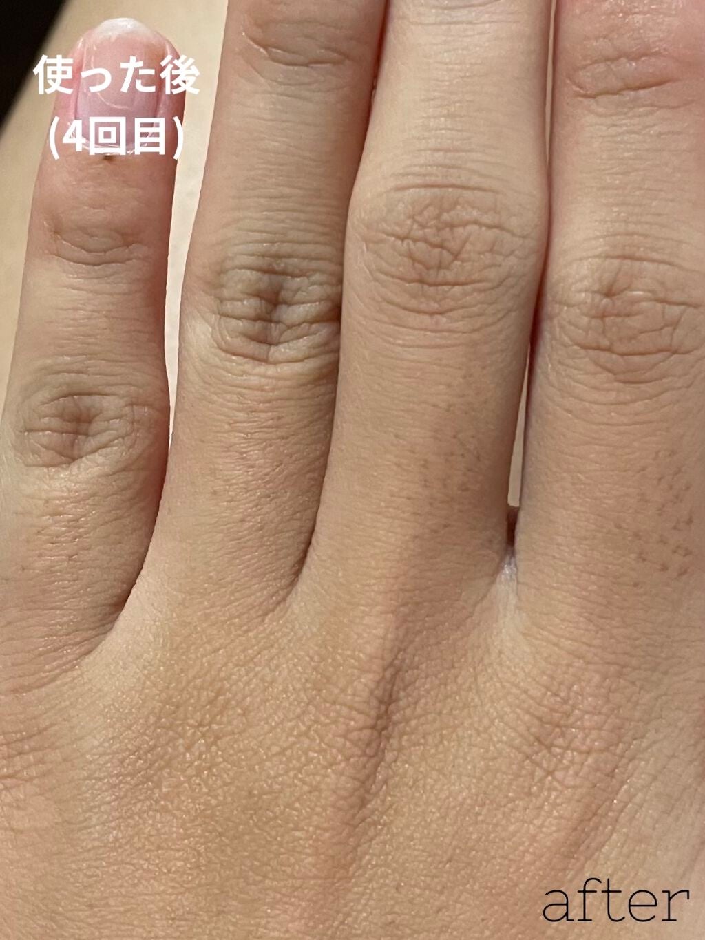 FASIZ HAIR REMOVAL 家庭用脱毛器/FASIZ/家庭用脱毛器を使ったクチコミ(5枚目)