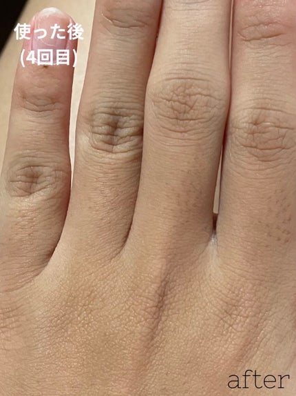 FASIZ HAIR REMOVAL 家庭用脱毛器/FASIZ/家庭用脱毛器を使ったクチコミ(5枚目)