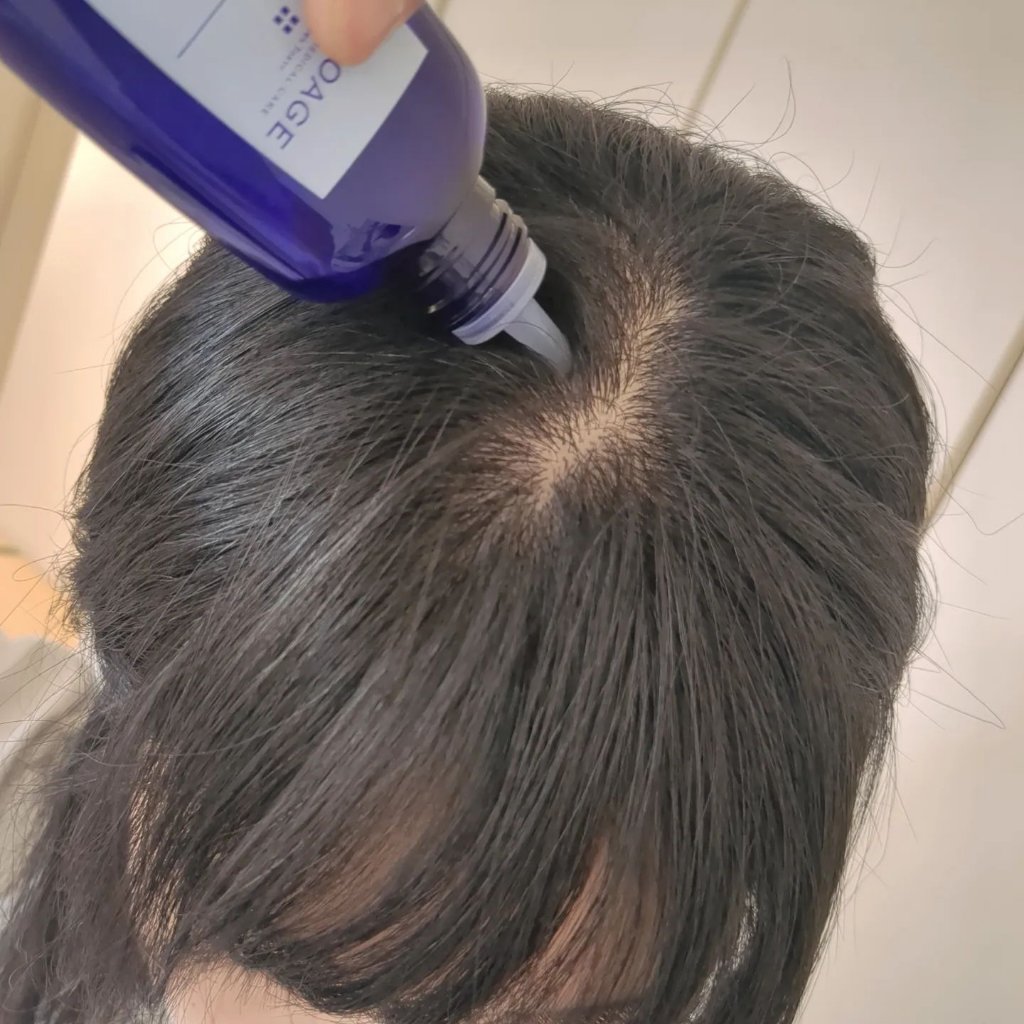 Wアプローチヘアプログラム/MUNOAGE(ミューノアージュ)/頭皮ローションを使ったクチコミ（3枚目）