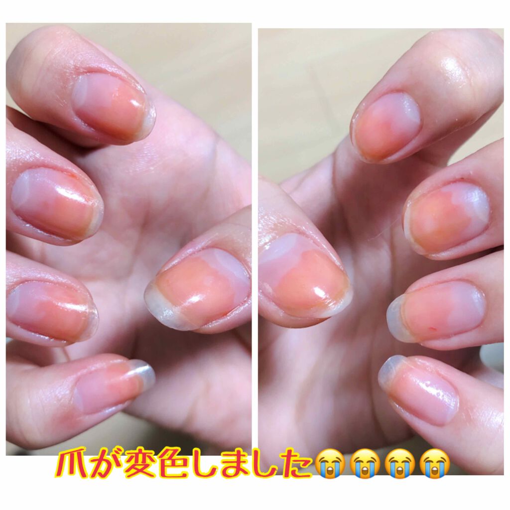 ピールオフマニキュア キャンドゥを使った口コミ 100円ショップのネイルでセル By かぴ 混合肌 代後半 Lips