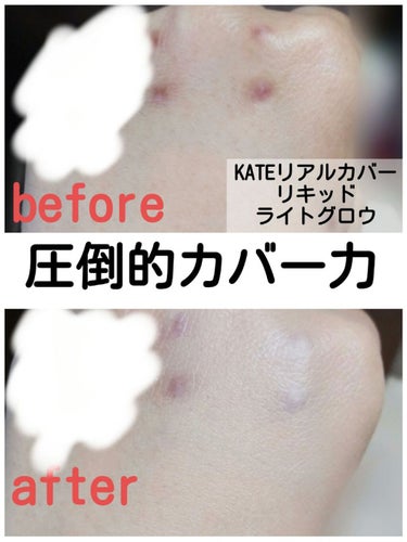 今日は、LIPSを通してKATEさんから「リアルカバーリキッド(ライトグロウ)」を頂いたので、そのレビューをしていこうと思います！！

1枚目の写真でもわかるように、カバー力がとにかく凄いです！生まれて