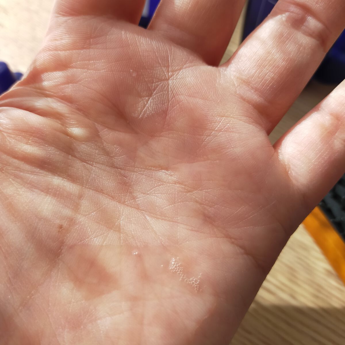 Wアプローチヘアプログラム/MUNOAGE(ミューノアージュ)/頭皮ローションを使ったクチコミ（3枚目）