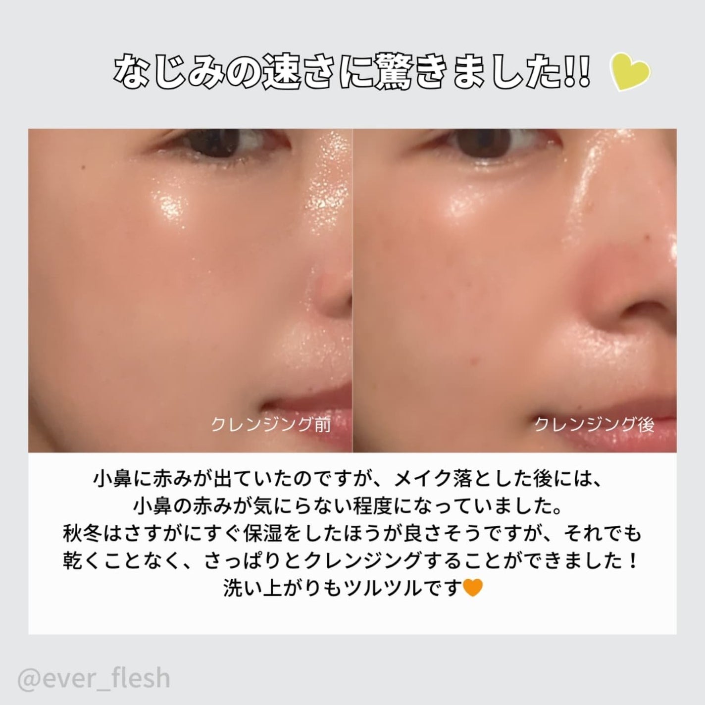 MUGWORT PORE CARE ALL IN ONE DEEP CLEANSING/VELLA/クレンジングバームを使ったクチコミ(4枚目)