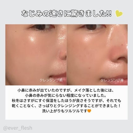 MUGWORT PORE CARE ALL IN ONE DEEP CLEANSING/VELLA/クレンジングバームを使ったクチコミ(4枚目)