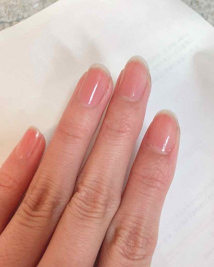 ネイルサポート ピンク/ネイルネイル/ネイルベースコートを使ったクチコミ(3枚目)