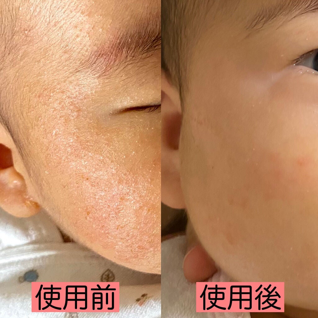 ローション/キュレル/ボディローションを使ったクチコミ(2枚目)