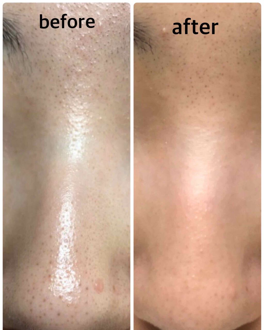 皮脂トラブルケア ミニセット/キュレル/スキンケアキットを使ったクチコミ(2枚目)