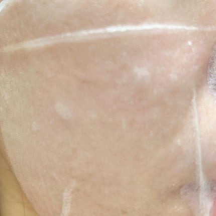 ガラクトミセスソフトニングアンプルマスク/TIRTIR(ティルティル)/シートマスク・パックを使ったクチコミ(4枚目)