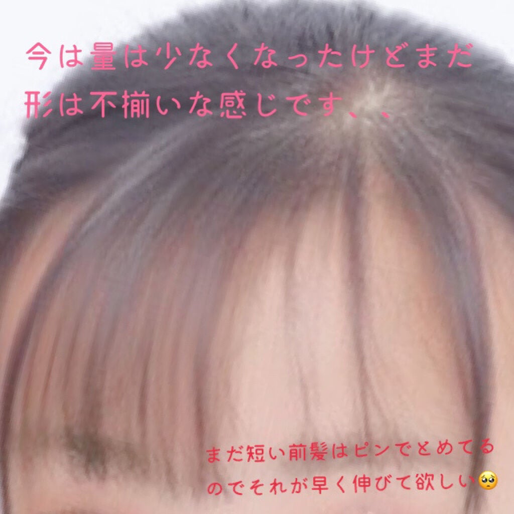 moka on LIPS 「今回は私の『前髪』事情についてです🥺私はどちらか半分の毛量が少..」(3枚目)