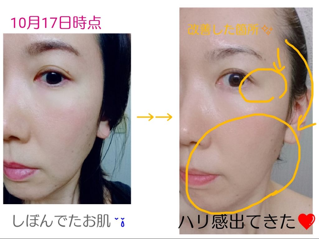 ã¢ã€ãã¹ ãªã³ã¯ã«OïŒL ã³ã³ã»ã³ãã¬ãŒã/DECENCIA/çŸå®¹æ¶²ã䜿ã£ãã¯ãã³ãïŒ4æç®ïŒ