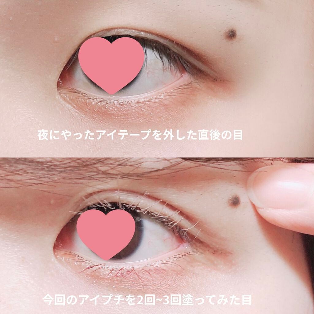 TWOOLダブルアイリッドハイブリットフィルム/SHOBIDO/二重まぶた用アイテムを使ったクチコミ(2枚目)