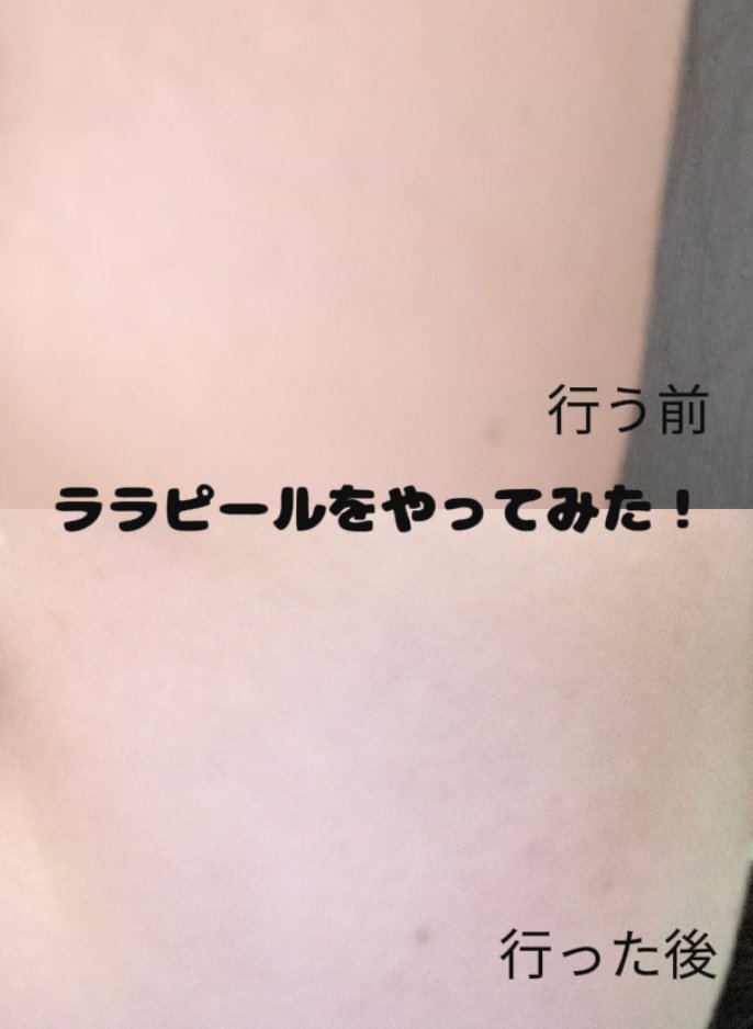 を使ったクチコミ（1枚目）