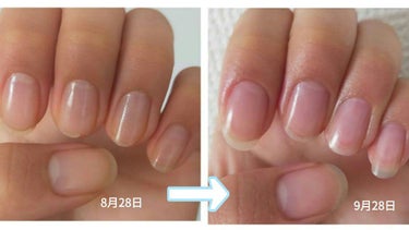 キューティクルネイルオイル ペンタイプ/No nail No life/ネイル用品を使ったクチコミ（2枚目）