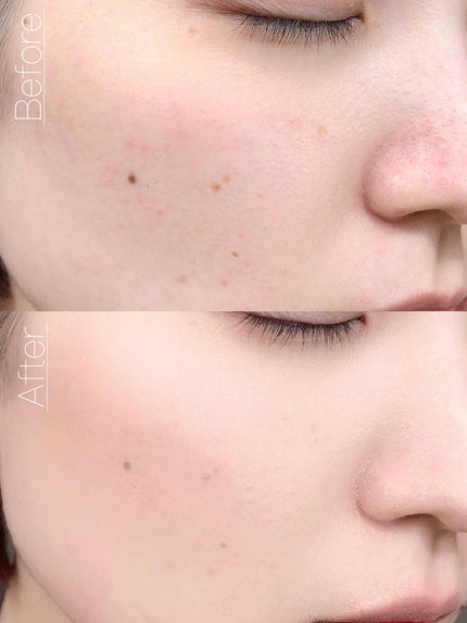 (旧)アンリミテッド ラスティング フルイド/shu uemura/リキッドファンデーションを使ったクチコミ(8枚目)