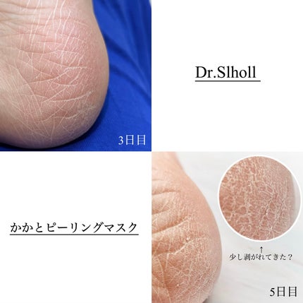 かかとピーリングマスク/ドクター・ショール/レッグ・フットケアを使ったクチコミ(5枚目)