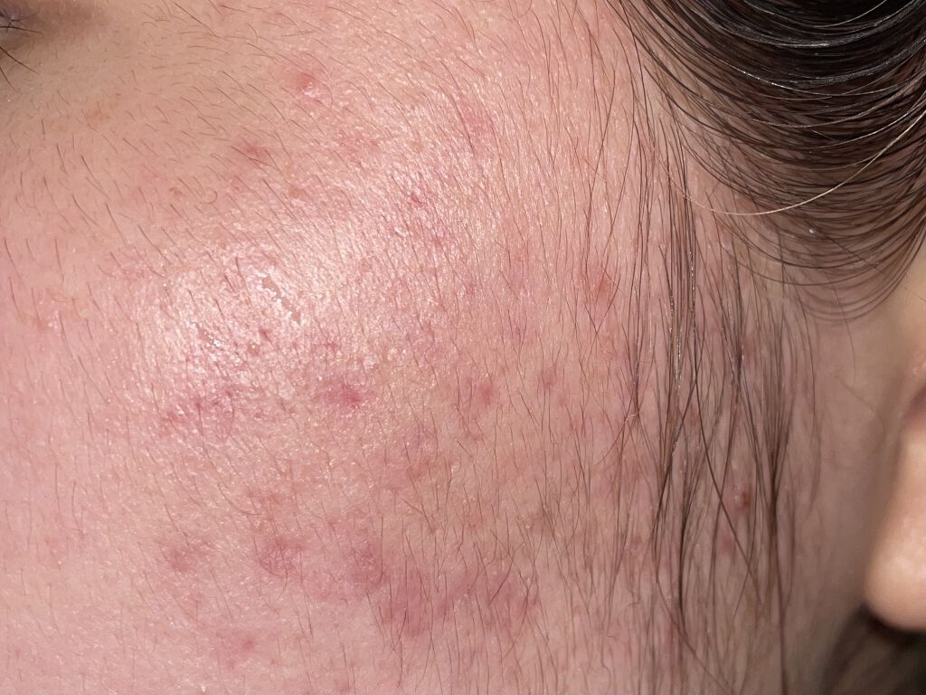 薬用 雪肌精/雪肌精/化粧水を使ったクチコミ（1枚目）