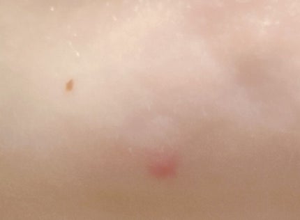 ホワイトアップ ローション(II)/アクアレーベル/化粧水を使ったクチコミ(2枚目)