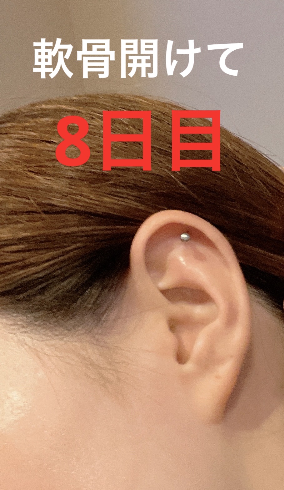 瞬間ピアッサー Q66｜ヒーロー の口コミ - 軟骨ピアスを開けて8日目が