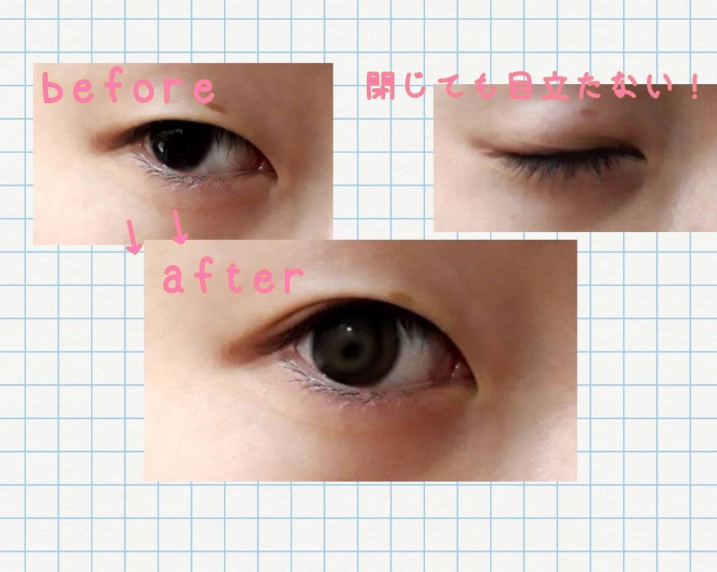 救急ばんそうこう/ドン・キホーテ/その他を使ったクチコミ（2枚目）