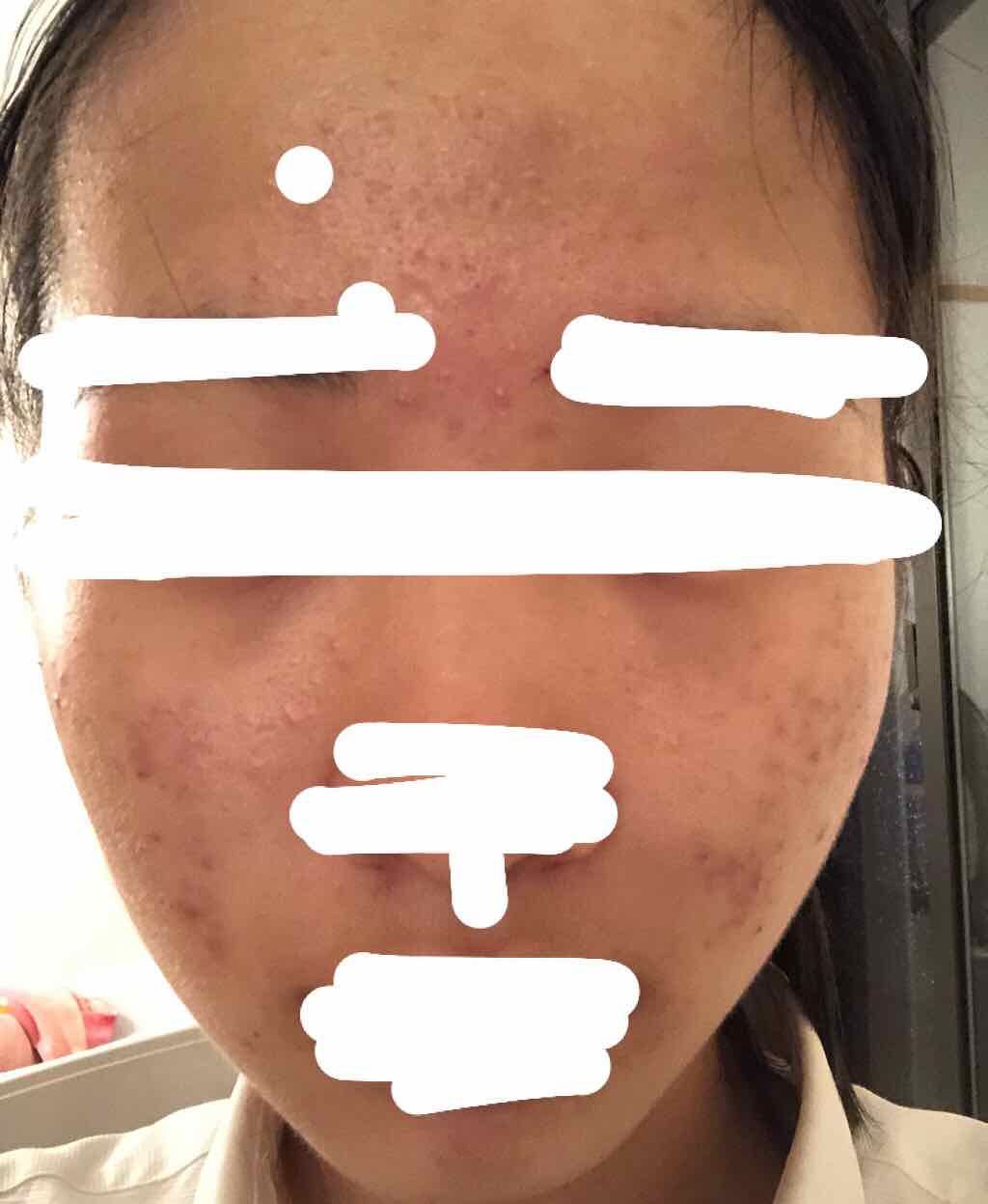 ビジャ シカバーム EX/innisfree/フェイスバームを使ったクチコミ（2枚目）