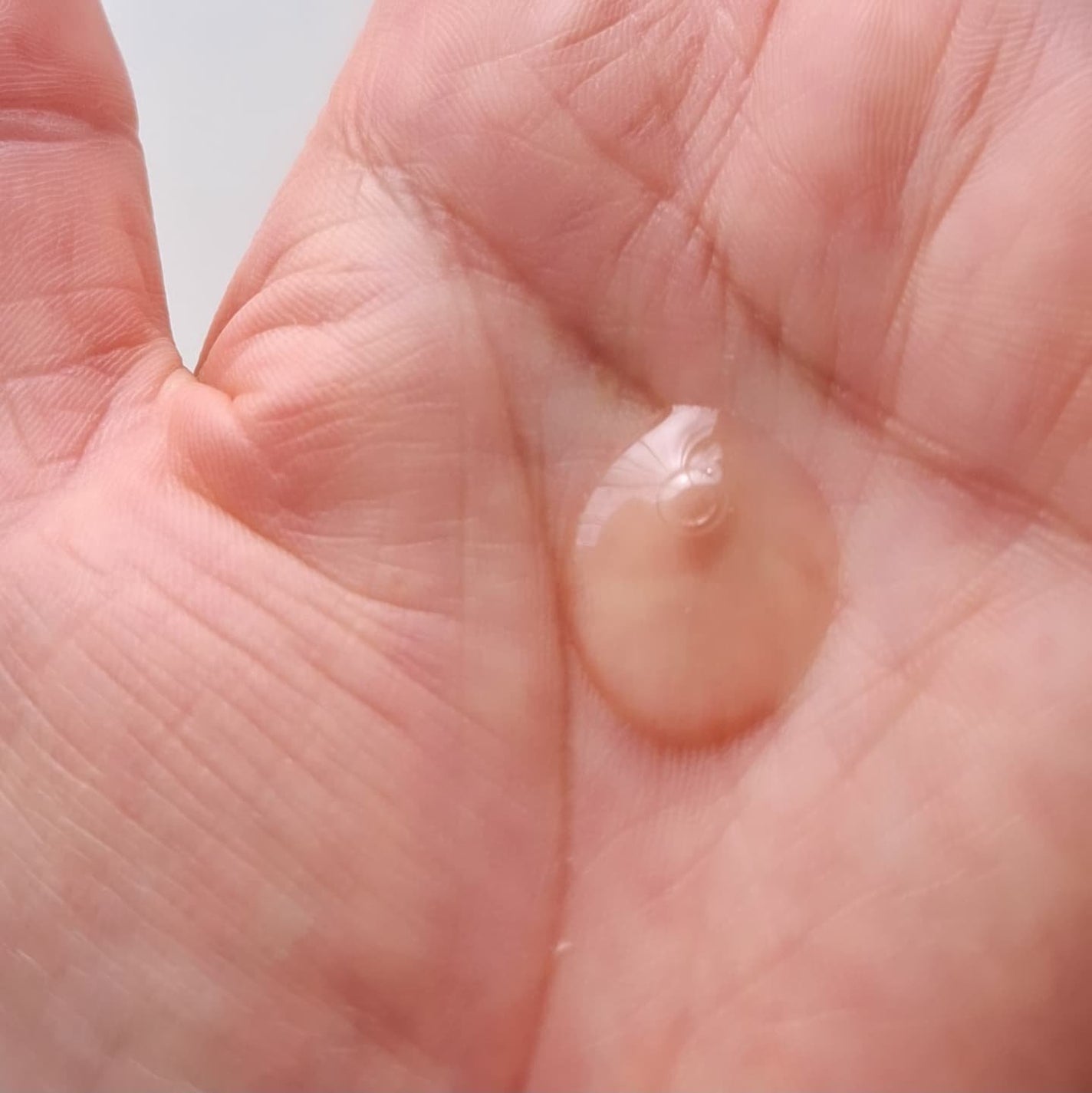 Cemenrete Calcium Intense Cream/Dr.Melaxin/フェイスクリームを使ったクチコミ(2枚目)