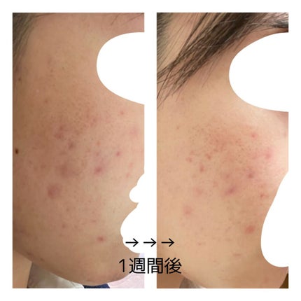 㪠㪠ð§žâ¡ on LIPS ããããæ¥èš3é±éç®2021/02/25ææŽé¡æããŒãããã¹ã¿é..ãïŒ5æç®ïŒ