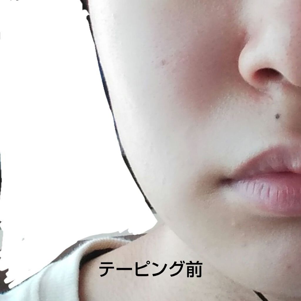 半透明で目立ちにくいサージカルテープ Daisoの口コミ 超優秀 100均で買えるおすすめコスメ コスプレメイクテーピン By クレ ゆんゆん 脂性肌 10代後半 Lips 半透明で目立ちにくいサージカルテープ Daisoの口コミ 超優秀 100均で買えるおすすめコスメ コスプレメイクテーピン By クレ ゆんゆん 脂性肌 10代後半 Lips