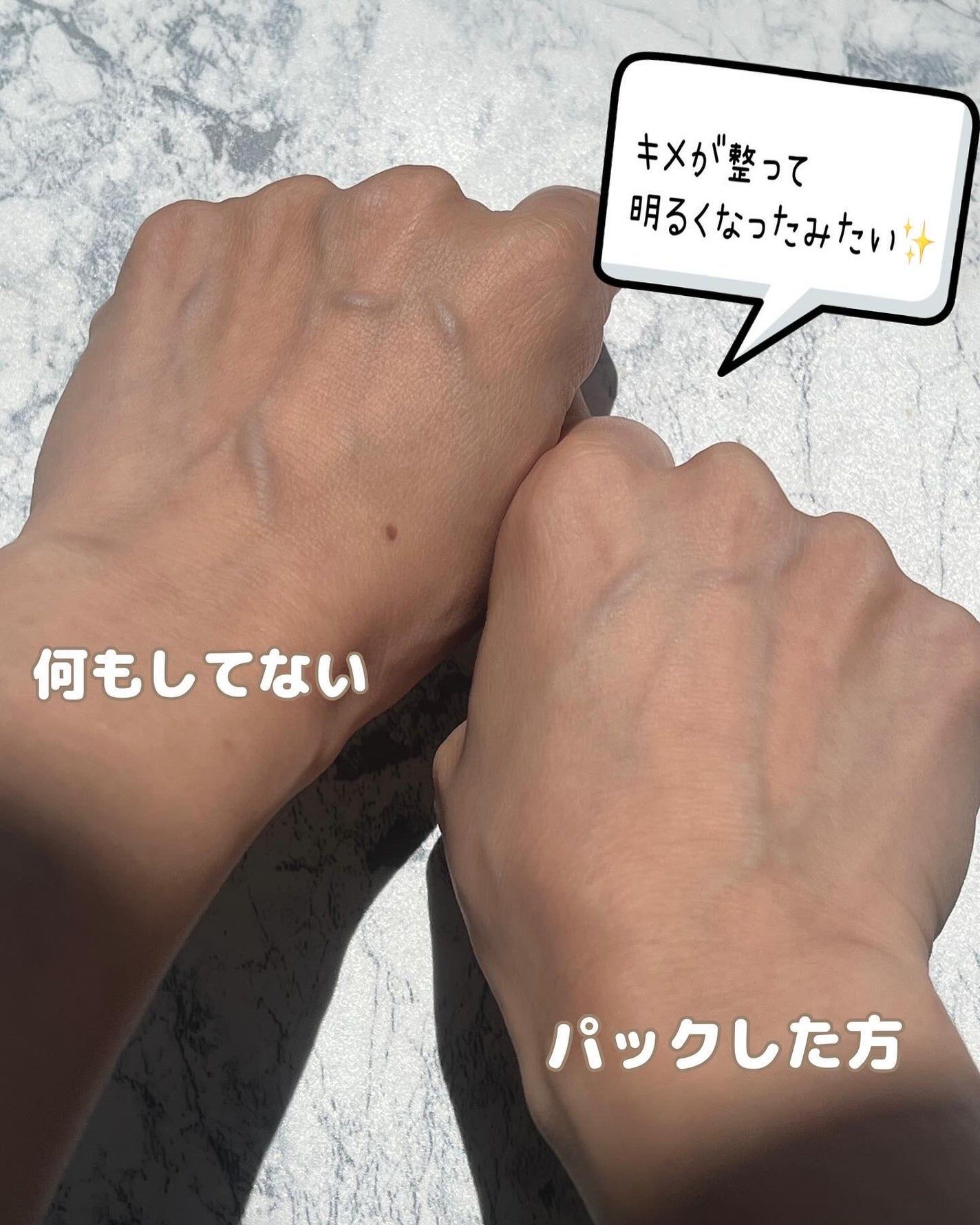 シャンティ on LIPS 「お家でエステ気分/肌の悩みを洗い流す/------------..」(5枚目)