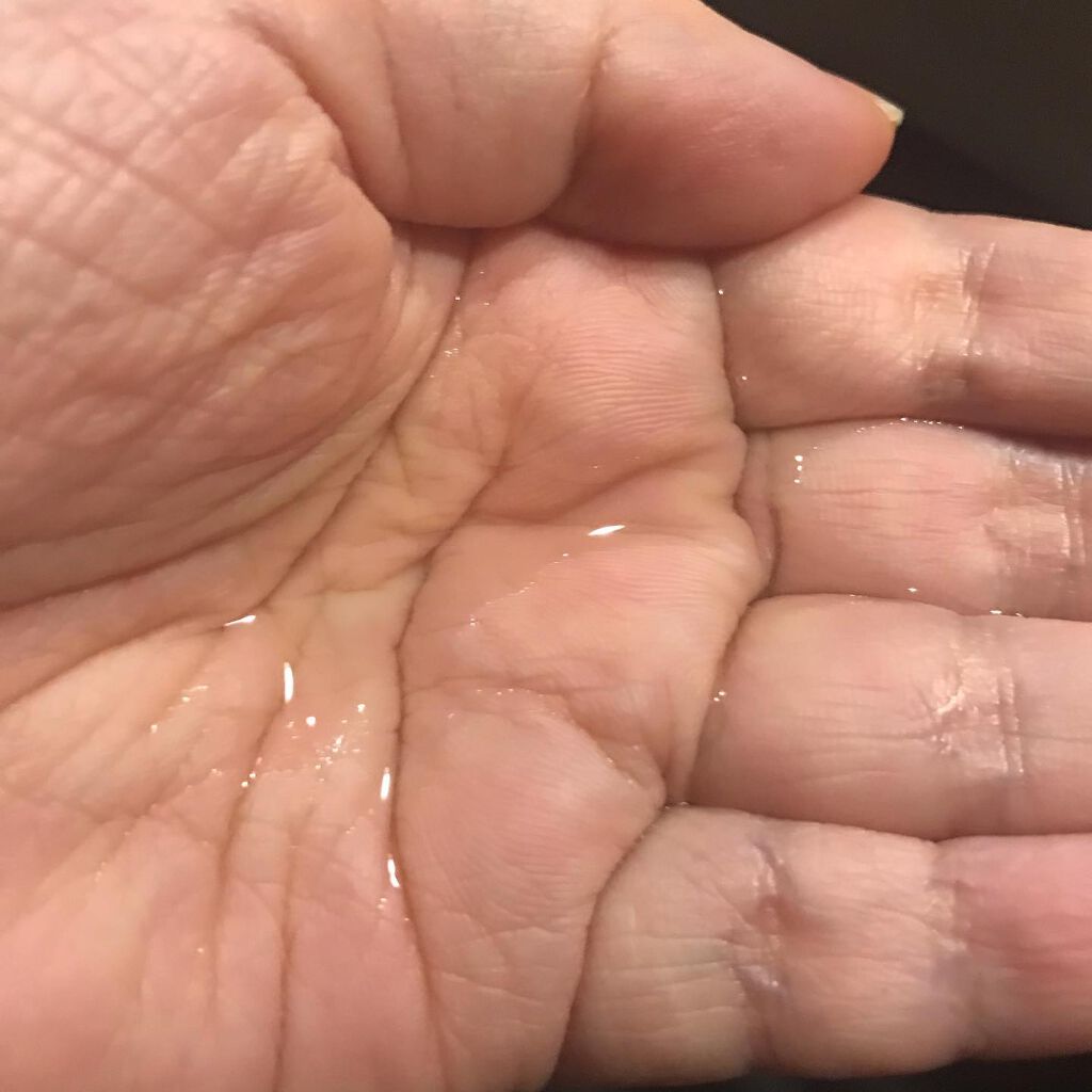 薬用モイストローション/NALC/化粧水を使ったクチコミ（2枚目）