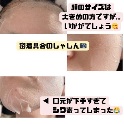 レチビタエッセンスマスク/ピュレア/シートマスク・パックを使ったクチコミ(3枚目)