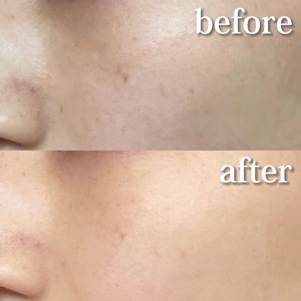 Melano Hunt/fibonacci/化粧水を使ったクチコミ(2枚目)