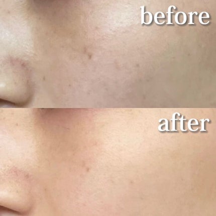 Melano Hunt/fibonacci/化粧水を使ったクチコミ(2枚目)