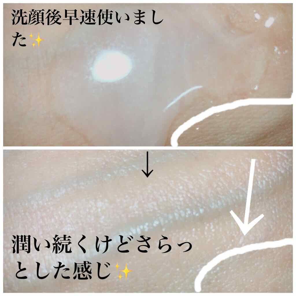 モイスチュア リポソーム/DECORTÉ/美容液を使ったクチコミ(2枚目)