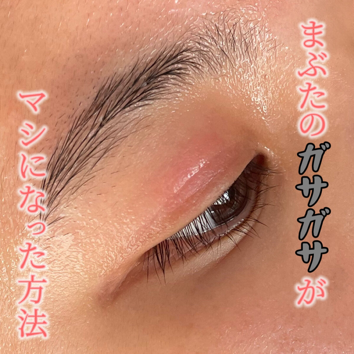 ピアソンＨＰクリーム(医薬品)/ピアソンHP/その他を使ったクチコミ（1枚目）