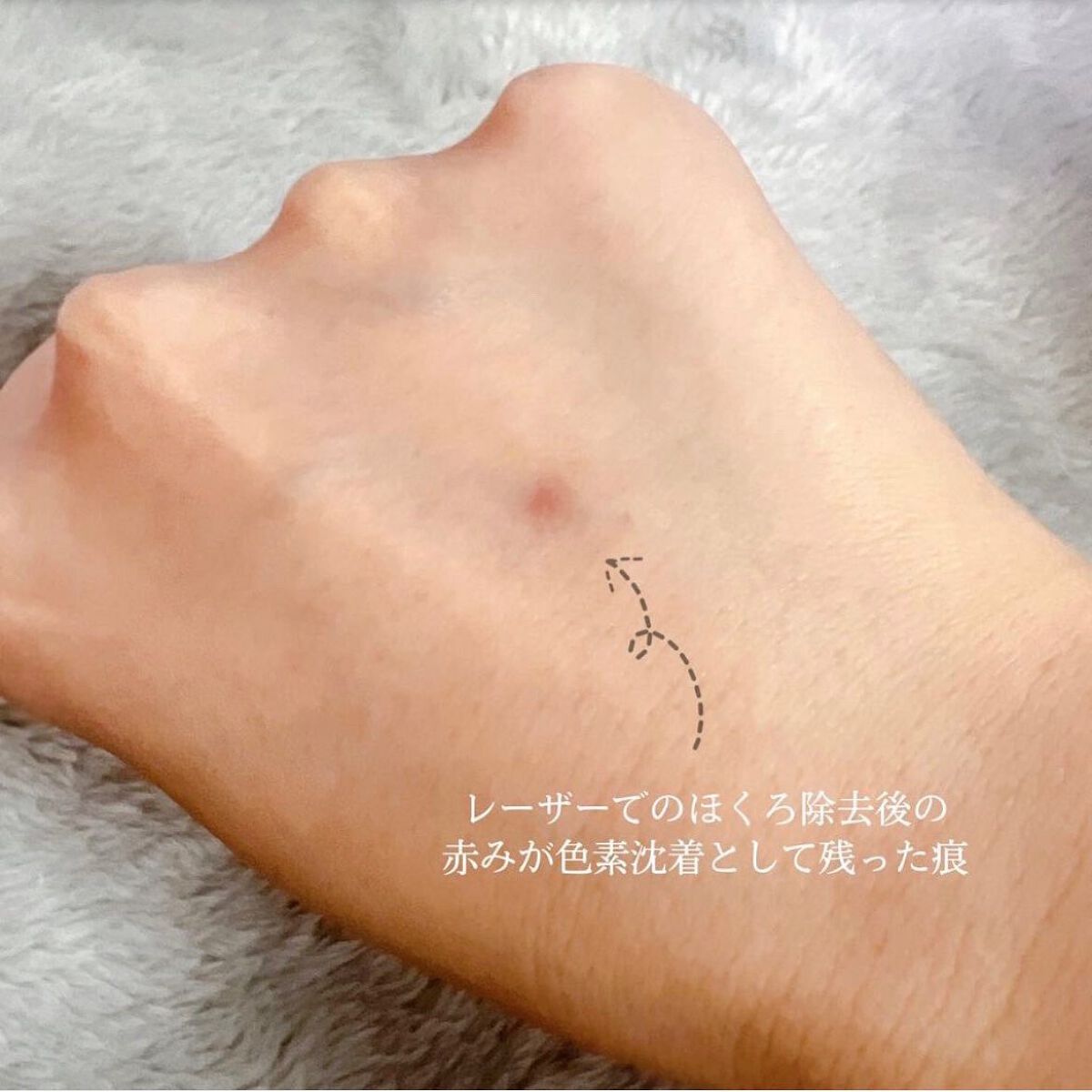 マーシュフィールド SC クリームファンデS 30/マーシュ・フィールド/クリーム・エマルジョンファンデーションを使ったクチコミ（3枚目）