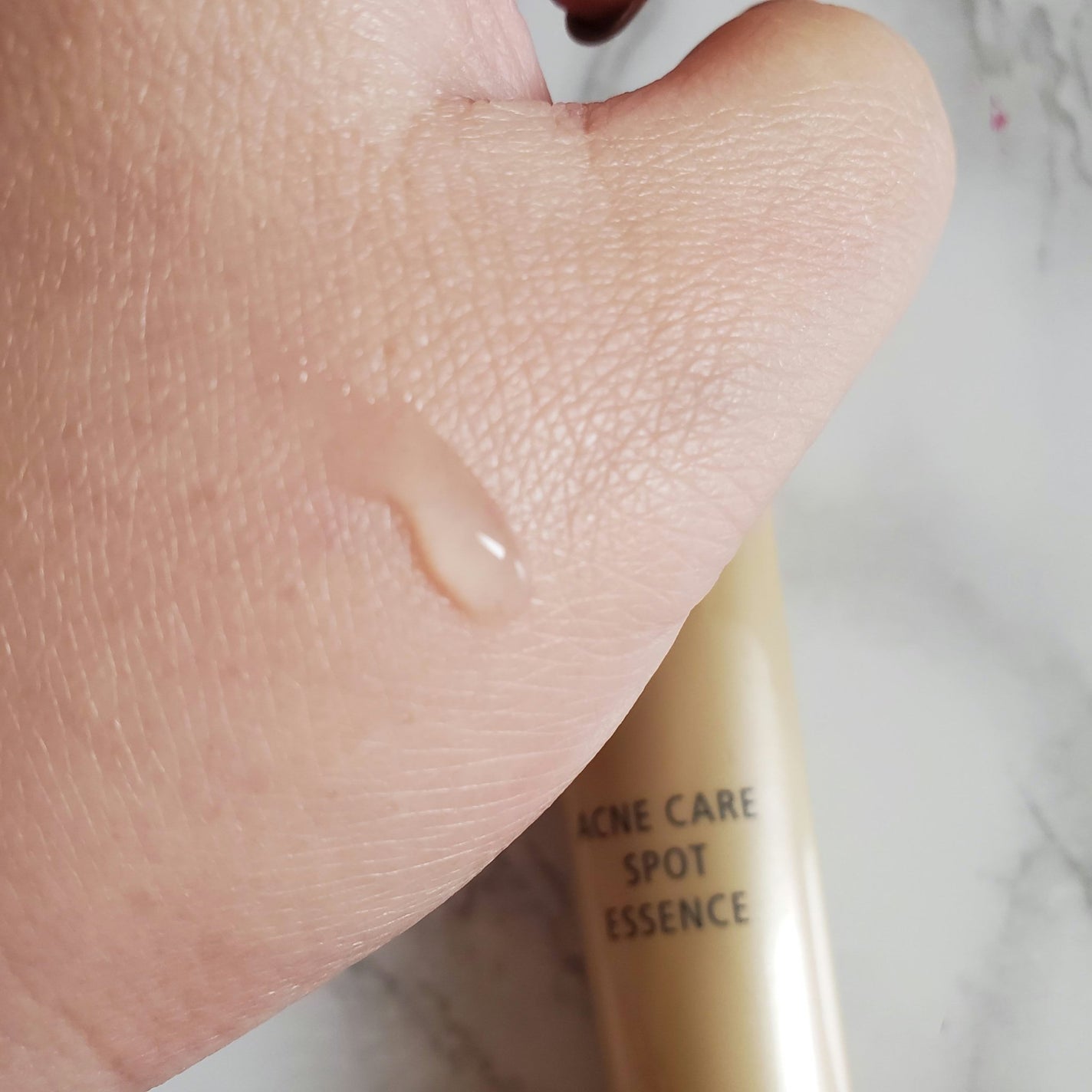 薬用 アクネケア美容液/d プログラム/美容液を使ったクチコミ(3枚目)