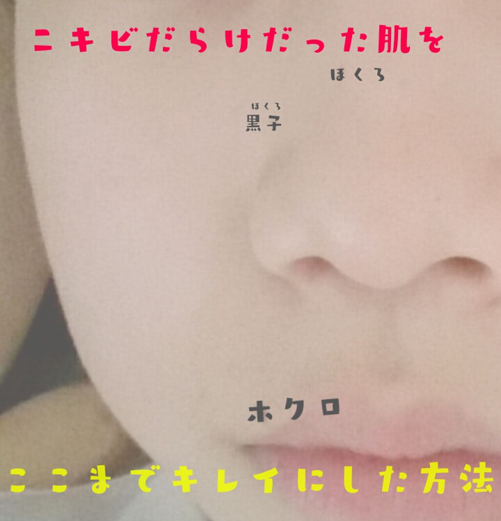 薬用保湿化粧水/オードムーゲ/化粧水を使ったクチコミ(1枚目)