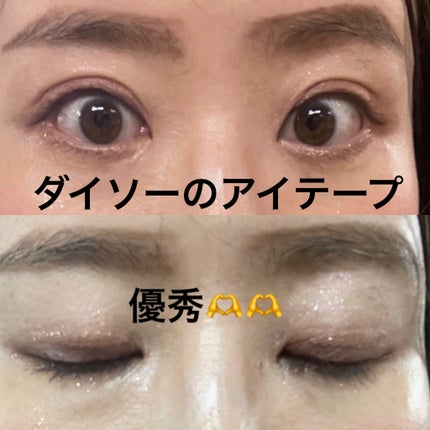 メッシュアイテープ/DAISO/二重まぶた用アイテムを使ったクチコミ(1枚目)