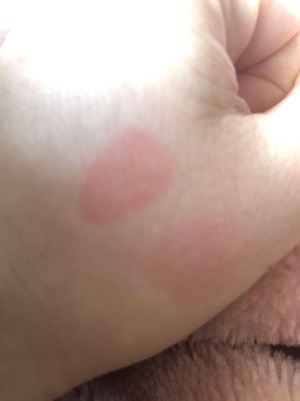 ジェルフィットティント/AMUSE/リップティントを使ったクチコミ(1枚目)