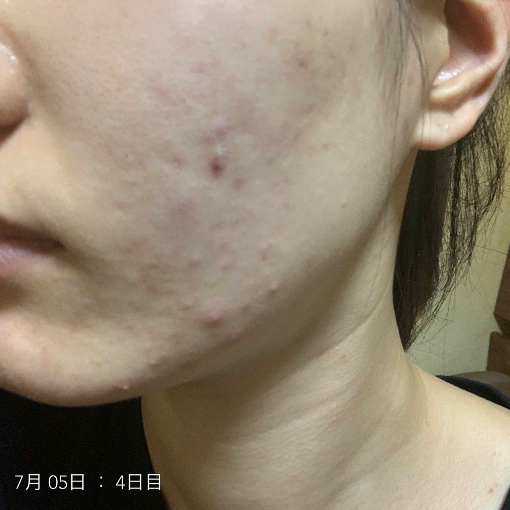 ハトムギ保湿ジェル(ナチュリエ スキンコンディショニングジェル)/ナチュリエ/美容液を使ったクチコミ（3枚目）