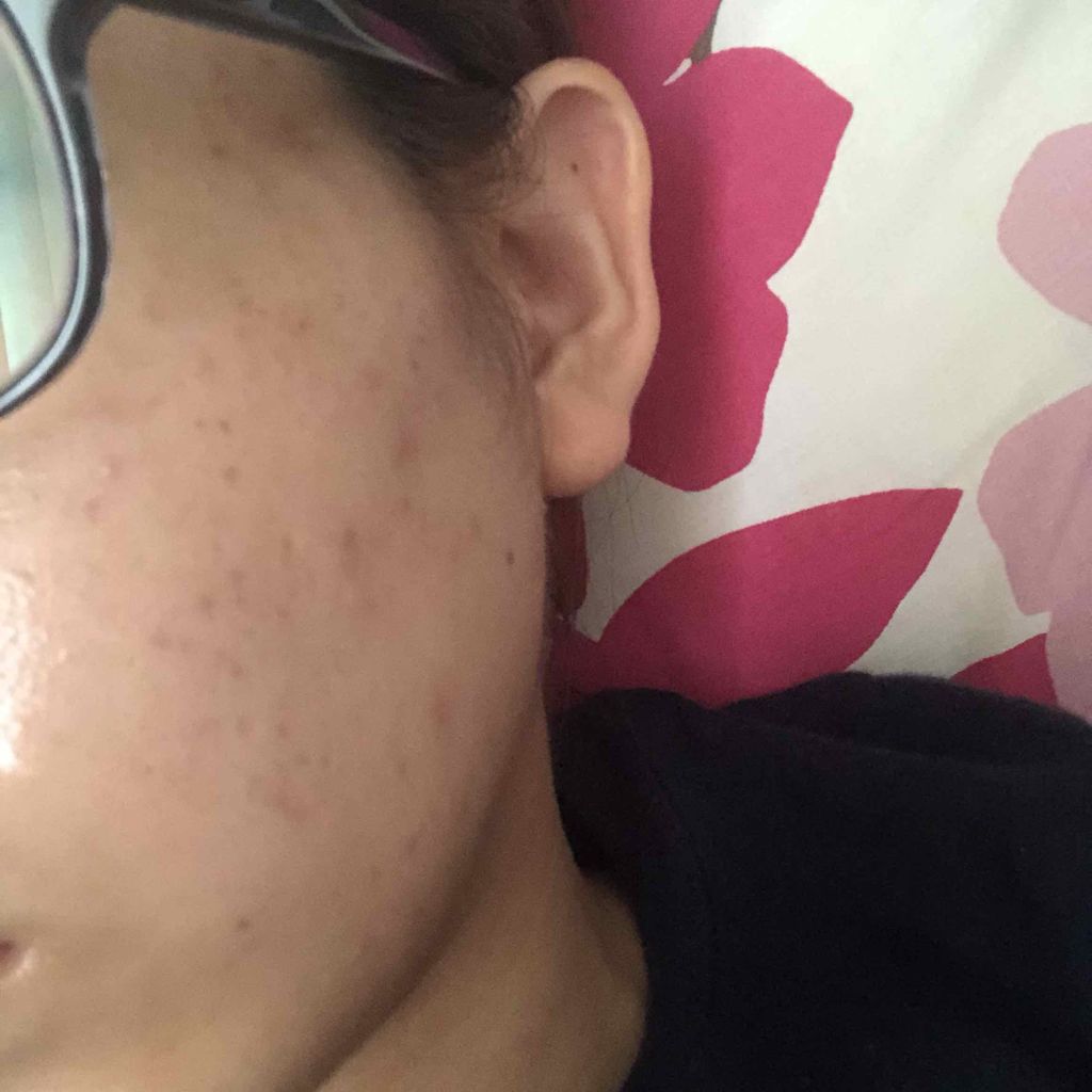 明色美顔水 薬用化粧水/美顔/化粧水を使ったクチコミ(2枚目)