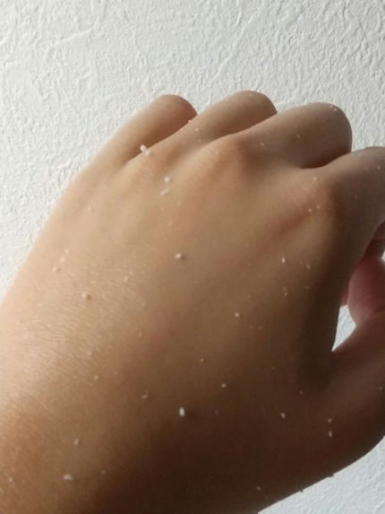 フェイスピーリングジェル ピーチの香り/DAISO/ピーリングを使ったクチコミ(3枚目)