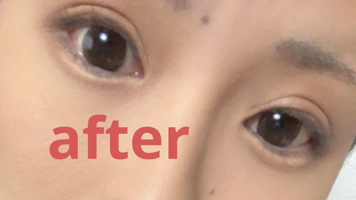 ナチュラルアイテープ/Automatic Beauty/二重まぶた用アイテムを使ったクチコミ（2枚目）