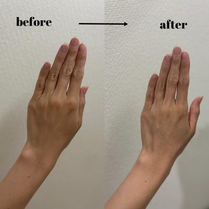 リードルショット300/VT/美容液を使ったクチコミ(7枚目)