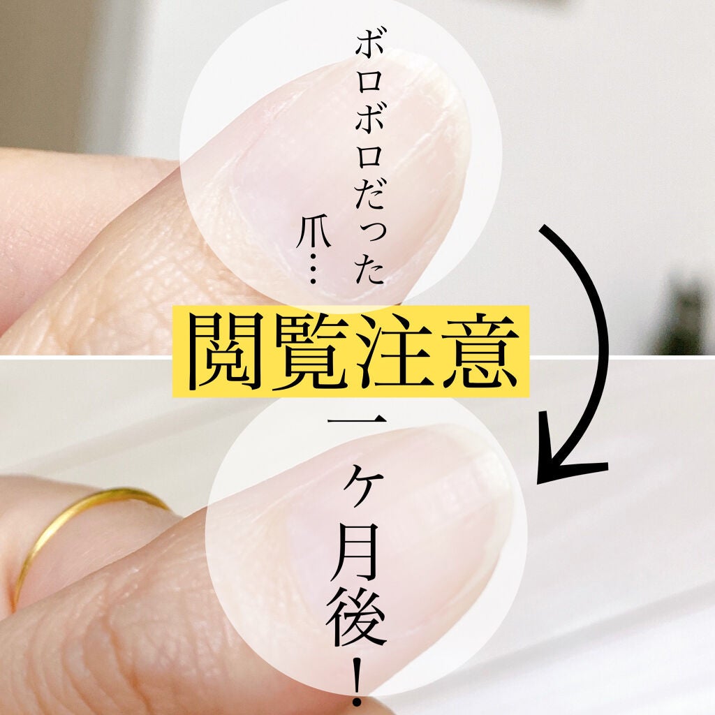 ネイリッチ/DHC/健康サプリメントを使ったクチコミ(1枚目)