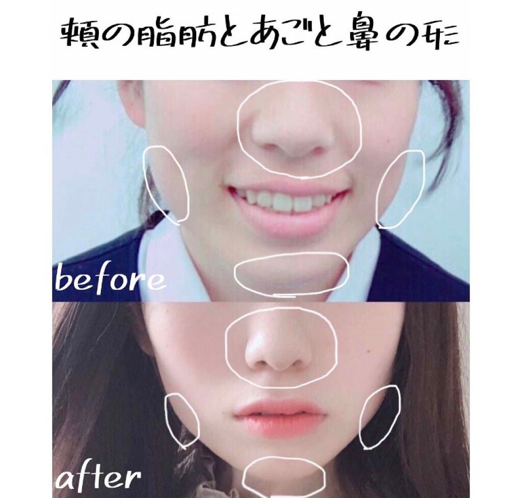 ニベアクリーム/ニベア/ボディクリームを使ったクチコミ(1枚目)