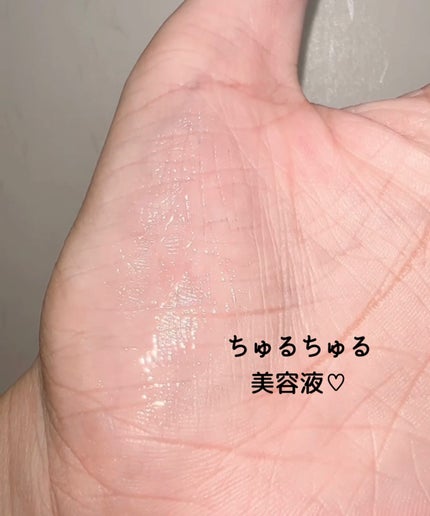 リンクルリップエッセンス プランパー/ザ・レチノタイム/リッププランパーを使ったクチコミ(5枚目)