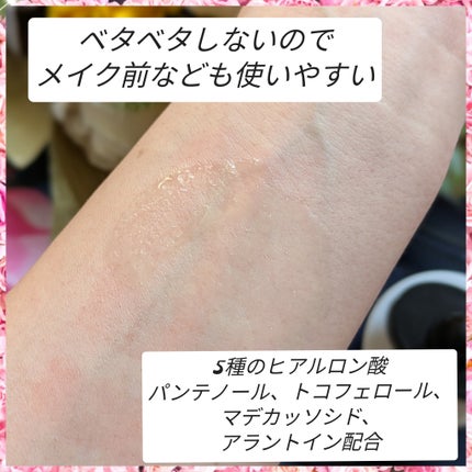 RXザ・アルファアルブチン2 ニキビ跡ケアセラム/COSRX/美容液を使ったクチコミ(5枚目)