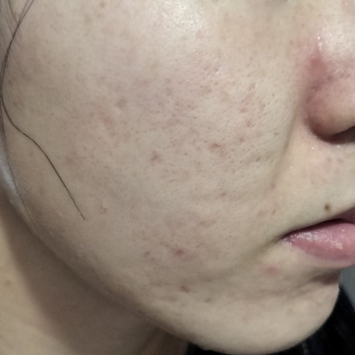 miina@汚肌工事録⚠️ on LIPS 「10/19の#汚肌工事録salamat🇵🇭/❤スキンケア☀朝#..」(1枚目)