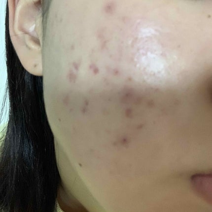 パワーマスク SP/ラッシュ/スクラブ・ゴマージュを使ったクチコミ(1枚目)